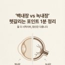 죽전안과의원 이미지