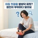 발바닥 통증 원인 체중 증가로 인한 불편함 대처 알아보기 이미지