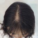 헤어달로스 | 고개를 숙일 때마다 신경 쓰인다면? 제주 두피염색 제주시 두피페인팅 헤어달로스