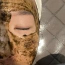 [울산 에스테틱]‘뷰티클라쓰’ / 여드름관리+데콜테후기