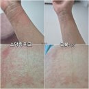 동탄삼성약국 | [임출육] 32주 태동검사,그리고 24시간 고문당하는 임신 소양증 극복 과정