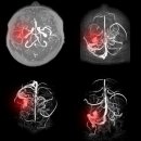 청혈한의원 이미지