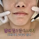 크레이지 | 갈매동 벨로셀에스테틱 피부상태 정밀진단 후 맞춤형 관리 크레이지 고주파 후기