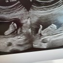 분당-22 | 임신 22주 분당차병원 정밀초음파 후기 /장지현 교수님 진료 +16주 기형아 검사 결과