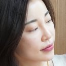 얼굴광 살리기 좋은 <b>레필레오</b> 스킨부스터 1회차 후기