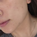 큐엘메디스킨 부천점 이미지