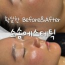 소솜에스테틱 - 전주시 덕진구 | 소솜에스테틱