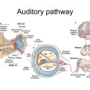 소리귀보청기 이미지