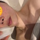 신사 피부관리 이지슬림스파 신사본점 고경미성형케어 후기