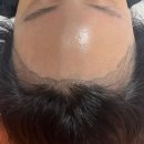 오던모발