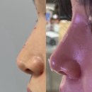 나한의원(쌍봉사거리) | 출산후 관리받으러 방문한 여수피부과 브랜드유의원 솔직후기 (코필러/콧볼보톡스/사각턱보톡스/미간...