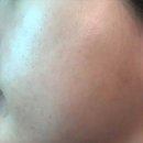 약국 재생연고 피부착색크림 병행 관리 찐 후기