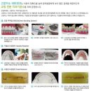 더고운치과기공소 네이버블로그