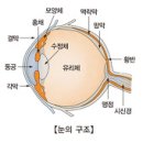 비문증(날파리증) 이미지