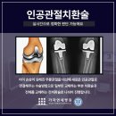 김포퇴행성관절염 무릎손상으로 걷기 어려워요 이미지
