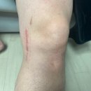 아이허브유 | 무릎보호대추천 ㅣ VIVEHEALTH, 무릎아대, 등산용 무릎아대