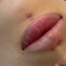 수목458 | 광진구 피부관리 바나나부띠끄 내돈내산 재방문후기