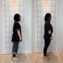 메디칼매니지먼트그룹아이 | 부평 키즈 필라테스 발목 염좌 후 움직임 회복 과정과 자세 변화 후기!!