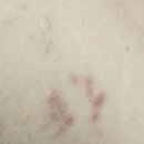 힐통증의학과의원 이미지