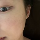 러블리페이스스킨케어 | 은평구 피부관리 에스테틱 예쁘다스킨케어 페이스관리 데콜테 솔직후기