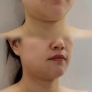 아벨라 에스테틱 | 대전 탄방동 윤곽관리 잘하는곳, 아벨라뷰티 후기