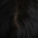 (주)시선바이오머티리얼스 | 탈모주사 메조테라피 효과