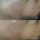 에스테티아전주완산 | 에스테티아 전주완산1호점 전주에스테틱샵 후기 좋은 곳