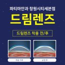아이줌안경콘텍트 이미지