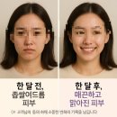 보석힐링다이어트