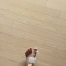 주식회사 엄지 | 무지외반증교정기 추천! 케어풋 2주 사용 후기