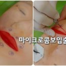 TJ메디칼 이미지