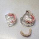 예일치과 이미지