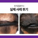 선일초등학교 | 은평구탈모치료, 3개월 안에 효과 봤다는 후기 진짜일까?