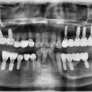 바른정치과의원 이미지