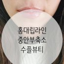 추라인뷰티 | 홍대립라인 어려보이는 중안부축소후기, 수플뷰티