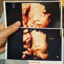 (주)레이커온라인 | [쌍둥이임신 27-28주] 갑자기 짧아진 자궁경부길이| 맘스바디케어 엔더몰로지 관리| 코베 베이비페어...
