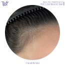 시크릿헤어 이미지