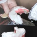 채움치과기공소 이미지