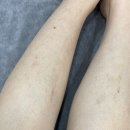 라;루나 | 부산 명지 왁싱 다리하프 슈가링 만족했던 루나라슈가링왁싱 부산명지센터 후기