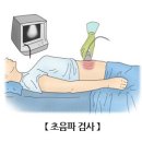 초음파 검사(Echography) 이미지