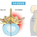 손발 저림 원인 알아봐요 이미지