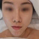 성남 모란역 피부관리 에스테틱 오라스킨케어 추천 후기