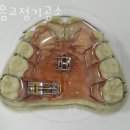 이음치과기공소 이미지