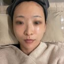청담 라라필피부관리 솔직후기