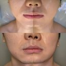 투왁싱&스파 | 해운대 윤곽 리프팅 4D입체윤곽리프팅 관리 더함에스테틱 해운대본점