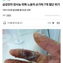 삼성전자 방사능 피폭 노동자 손가락 7개 절단 위기 이미지