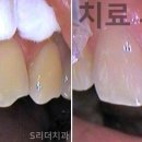 리더치과기공소 이미지