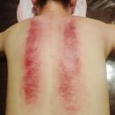 황후메디칼 | [문래동피부관리/사운드바디사운드스킨] 순금으로 피부관리를 받았다