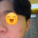 그린필 피부미용실 | 인천 용현동 피부관리 헤이유 슈가링왁싱&피부관리 다녀온 찐 후기-!