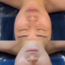 슈피부관리실 | 마산피부관리실 뷰티밤 슈디바 런칭 초음파 리프팅케어 후기